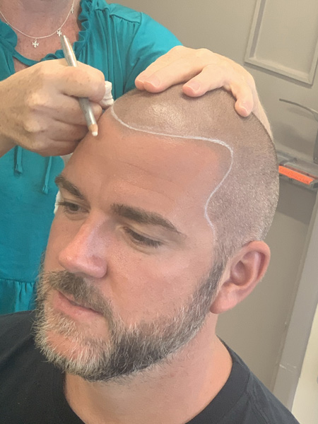 Scalp Micropigmentation Training