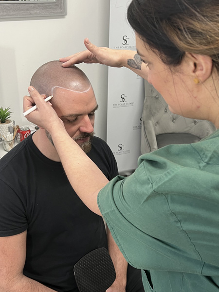 Scalp Micropigmentation Training